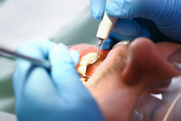 Best Tooth Infection Emergency Dentist  in Coon Rapids, MN